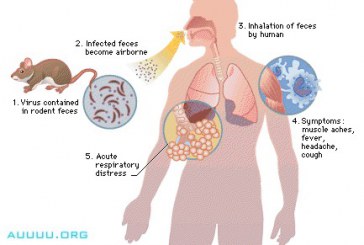 O femeie din raionul Orhei – la spital după ce a contactat un virus întâlnit rar în Moldova